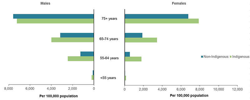 The bar graph shows atrial fibrillation hospitalisation rates by indigenous status increased with age in 2017-18. Hospitalisation rates were higher among Indigenous males and Indigenous females for all ages, except males aged 75 and over. Non-Indigenous males aged 75+ years had the highest rate of hospitalisation at 7,578 per 100,000 population.