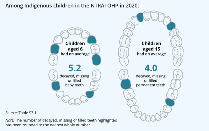 The infographic shows that Indigenous children aged 6 in the NTRAI OHP had on average 5.2 decayed, missing or filled baby teeth in 2020. For those aged 15 the average was 4.0 decaying, missing, or filled permanent teeth in 2020.