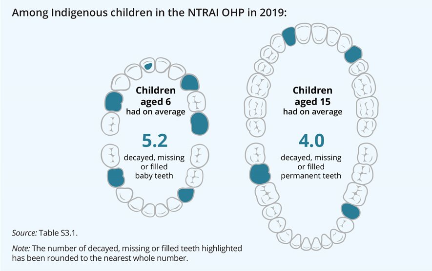 The infographic shows that, in 2019, children aged 6 had on average, the highest number of decayed, missing or filled baby teeth (5.2), and children aged 15 had on average, the highest number of decayed, missing or filled permanent teeth (4.0).