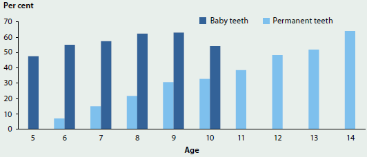 Column graph showing the proportion of children attending a school dental service with decayed, missing or filled teeth in 2010, by age and tooth type. Rates of damaged teeth, both baby teeth and permanent teeth, increase with age and are over 60%25 in children aged 14.