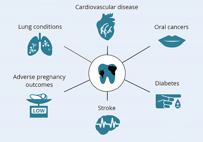 Diagram showing cardiovascular disease, lung conditions, oral cancers, adverse pregnancy outcomes, stroke and diabetes